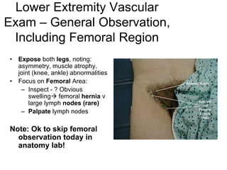 Lower Extremity Vascular
Exam – General Observation,
Including Femoral Region
• Expose both legs, noting:
asymmetry, muscle atrophy,
joint (knee, ankle) abnormalities
• Focus on Femoral Area:
– Inspect - ? Obvious
swelling femoral hernia v
large lymph nodes (rare)
– Palpate lymph nodes
Note: Ok to skip femoral
observation today in
anatomy lab!
 