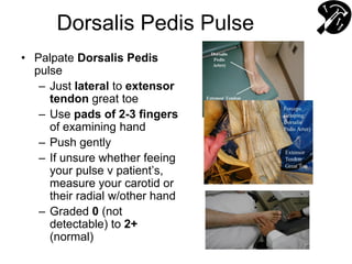 Dorsalis Pedis Pulse
• Palpate Dorsalis Pedis
pulse
– Just lateral to extensor
tendon great toe
– Use pads of 2-3 fingers
of examining hand
– Push gently
– If unsure whether feeing
your pulse v patient’s,
measure your carotid or
their radial w/other hand
– Graded 0 (not
detectable) to 2+
(normal)
 