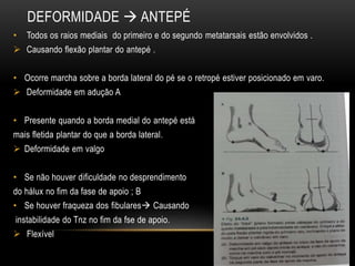 DEFORMIDADE  ANTEPÉ
• Todos os raios mediais do primeiro e do segundo metatarsais estão envolvidos .
 Causando flexão plantar do antepé .
• Ocorre marcha sobre a borda lateral do pé se o retropé estiver posicionado em varo.
 Deformidade em adução A
• Presente quando a borda medial do antepé está
mais fletida plantar do que a borda lateral.
 Deformidade em valgo
• Se não houver dificuldade no desprendimento
do hálux no fim da fase de apoio ; B
• Se houver fraqueza dos fibulares Causando
instabilidade do Tnz no fim da fse de apoio.
 Flexível
 