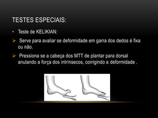 TESTES ESPECIAIS:
• Teste de KELIKIAN:
 Serve para avaliar se deformidade em garra dos dedos é fixa
ou não.
 Pressiona se a cabeça dos MTT de plantar para dorsal
anulando a força dos intrínsecos, corrigindo a deformidade .
 