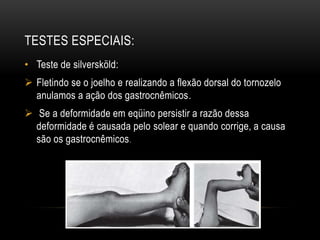 TESTES ESPECIAIS:
• Teste de silversköld:
 Fletindo se o joelho e realizando a flexão dorsal do tornozelo
anulamos a ação dos gastrocnêmicos.
 Se a deformidade em eqüino persistir a razão dessa
deformidade é causada pelo solear e quando corrige, a causa
são os gastrocnêmicos.
 