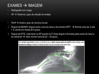 EXAMES  IMAGEM
• Radiografia com carga:
• AP  Observa o grau de adução do antepé
• Perfil  Avalia o grau do cavismo do pé;
 Ângulo de MEARY: ângulo entre o eixo do talus e do primeiro MTT.  Normal varia de -5 até
+ 5, sendo em media de 0 graus.
 Ângulo de KITE, vista tanto no AP quanto no P. Esse ângulo é formado pelos eixos do talus e
do calcâneo  Valor normal varia de 20 – 30 graus.
 