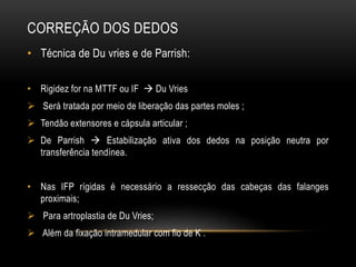 CORREÇÃO DOS DEDOS
• Técnica de Du vries e de Parrish:
• Rigidez for na MTTF ou IF  Du Vries
 Será tratada por meio de liberação das partes moles ;
 Tendão extensores e cápsula articular ;
 De Parrish  Estabilização ativa dos dedos na posição neutra por
transferência tendínea.
• Nas IFP rígidas é necessário a ressecção das cabeças das falanges
proximais;
 Para artroplastia de Du Vries;
 Além da fixação intramedular com fio de K .
 