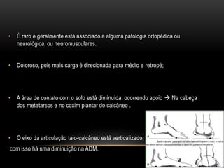 • É raro e geralmente está associado a alguma patologia ortopédica ou
neurológica, ou neuromusculares.
• Doloroso, pois mais carga é direcionada para médio e retropé;
• A área de contato com o solo está diminuída, ocorrendo apoio  Na cabeça
dos metatarsos e no coxim plantar do calcâneo .
• O eixo da articulação talo-calcâneo está verticalizado,
com isso há uma diminuição na ADM.
 