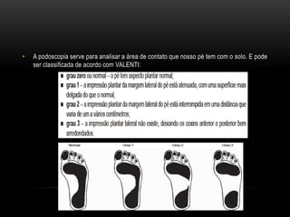 • A podoscopia serve para analisar a área de contato que nosso pé tem com o solo. E pode
ser classificada de acordo com VALENTI:
 