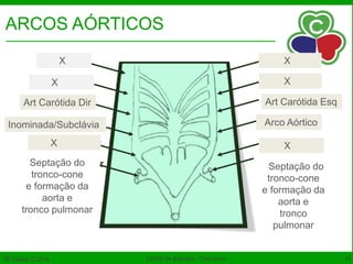 Noções de Embriologia 
ARCOS AÓRTICOS 
1º arco à dir 
X X 
2o arco à dir 
X X 
3o arco à dir 
Art Carótida Dir Art Carótida Esq 
4o arco à dir 
Inominada/Subclávia Arco Aórtico 
5o arco à dir 
X X 
Septação do 
tronco-cone 
e formação da 
6o arco à dir 
1o arco à esq 
2o arco à esq 
3o arco à esq 
4o arco à esq 
5o arco à esq 
6o arco à esq 
aorta e 
tronco pulmonar 
Septação do 
tronco-cone 
e formação da 
aorta e 
tronco 
pulmonar 
© Célula C 2014 Centro de Estudos - Caduceus 16 
 