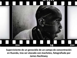 Superviviente de un genocidio de un campo de concentración
en Ruanda, tras ser atacado con machetes, fotografiado por
James Nachtwey