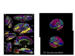 • Anatomical parcellation of the cortex in 75 ROIs for
each hemisphere and subject

GY freesurfer parcellated

 