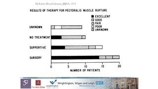 UN KNOWN
SUPPORTIVE
SURGERY
0
1044 J. E. MCENTIRE, W. E. HESS. AND S. S. COLEMAN
RESULTS OF THERAPY FOR PECTORALIS MUSCLE RUPTURE
:..:.1 L
. EXCELLENT
0 GOOD
0 FAIR
0 POOR
0 UNKNOWN
‘:ii
10 15 20
NO TREATMEN1
NUMBER OF PATIENTS
FIG. 5
Results of treatment suggest that surgical repair most often gives the best results, especially
with distal ruptures.
muscle, and postoperative support and therapy. Many patients who requested a late
McEntire,Hess,Coleman, JBJSA, 1972
 