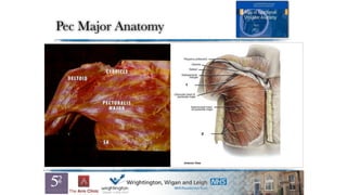 Pec Major Anatomy
 