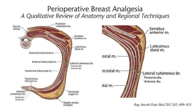 Pecs block, serratus plane block with literature review when and how | PPTX