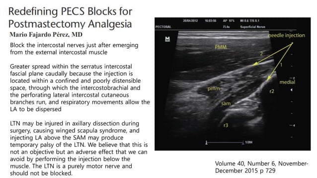 Pecs block, serratus plane block with literature review when and how | PPT