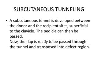 SUBCUTANEOUS TUNNELING
• A subcutaneous tunnel is developed between
the donor and the recipient sites, superficial
to the clavicle. The pedicle can then be
passed.
Now, the flap is ready to be passed through
the tunnel and transposed into defect region.
 