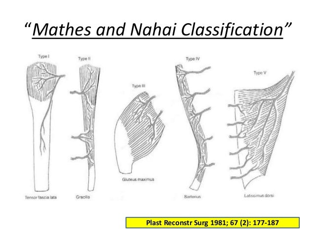 Pectoralis Major Myocutaneous Flap in Head and Neck Reconstruction