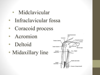 • Midclavicular
• Infraclavicular fossa
• Coracoid process
• Acromion
• Deltoid
• Midaxillary line
 