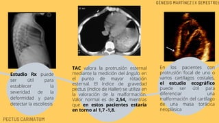 Estudio Rx puede
ser útil para
establecer la
severidad de la
deformidad y para
detectar la escoliosis
TAC valora la protrusión esternal
mediante la medición del ángulo en
el punto de mayor rotación
esternal. El índice de gravedad
pectus (índice de Haller) se utiliza en
la valoración de la malformación.
Valor normal es de 2,54, mientras
que en estos pacientes estaría
en torno al 1,7 -1,8.
En los pacientes con
protrusión focal de uno o
varios cartílagos costales,
el estudio ecográfico
puede ser útil para
diferenciar una
malformación del cartílago
de una masa torácica
neoplásica
PECTUS CARINATUM
GÉNESIS MARTÍNEZ | X SEMESTREt
 