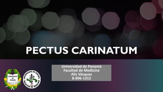 PECTUS CARINATUM
Universidad de Panamá
Facultad de Medicina
Alis Vásquez
8-896-1312
 