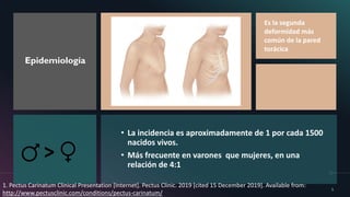 Epidemiología
• La incidencia es aproximadamente de 1 por cada 1500
nacidos vivos.
• Más frecuente en varones que mujeres, en una
relación de 4:1
5
>
Es la segunda
deformidad más
común de la pared
torácica
1. Pectus Carinatum Clinical Presentation [Internet]. Pectus Clinic. 2019 [cited 15 December 2019]. Available from:
http://www.pectusclinic.com/conditions/pectus-carinatum/
 