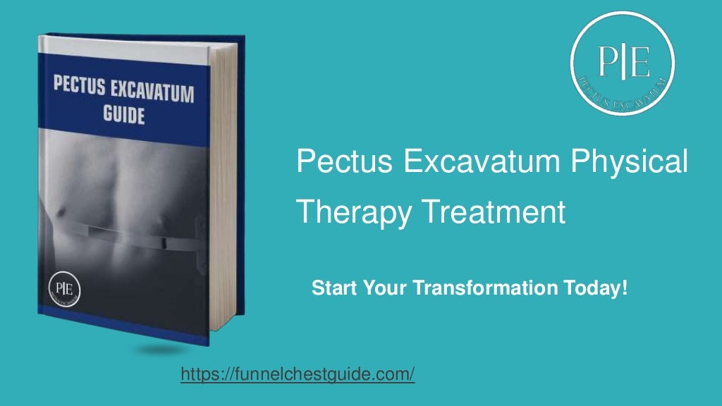 Pectus Excavatum Physical Therapy Treatment Funnel Chest Guide