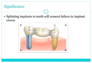 Significance
 Splinting implants to teeth will cement failure in implant
crown
 