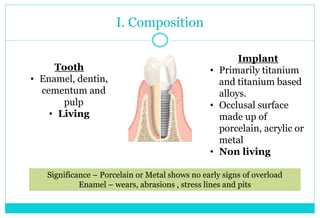 I. Composition
Tooth
• Enamel, dentin,
cementum and
pulp
• Living
Implant
• Primarily titanium
and titanium based
alloys.
• Occlusal surface
made up of
porcelain, acrylic or
metal
• Non living
Significance – Porcelain or Metal shows no early signs of overload
Enamel – wears, abrasions , stress lines and pits
 