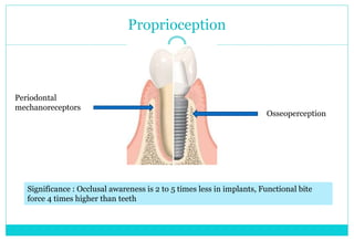 Proprioception
Periodontal
mechanoreceptors
Osseoperception
Significance : Occlusal awareness is 2 to 5 times less in implants, Functional bite
force 4 times higher than teeth
 