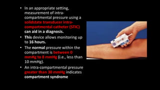 COMPARTMENT SYNDROME | PPTX