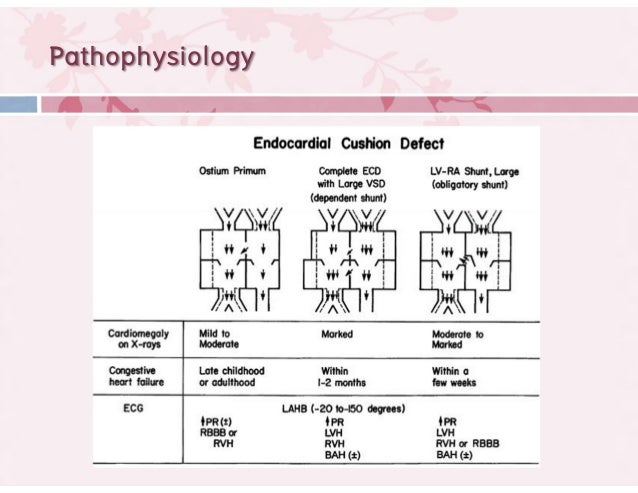Congenital Heart Disease