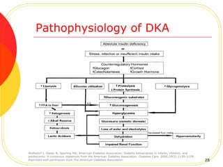 Pathophysiology of DKA
Wolfsdorf J, Glaser N, Sperling MA; American Diabetes Association. Diabetic ketoacidosis in infants, children, and
adolescents: A consensus statement from the American Diabetes Association. Diabetes Care. 2006;29(5):1150-1159.
Reprinted with permission from The American Diabetes Association. 28
 