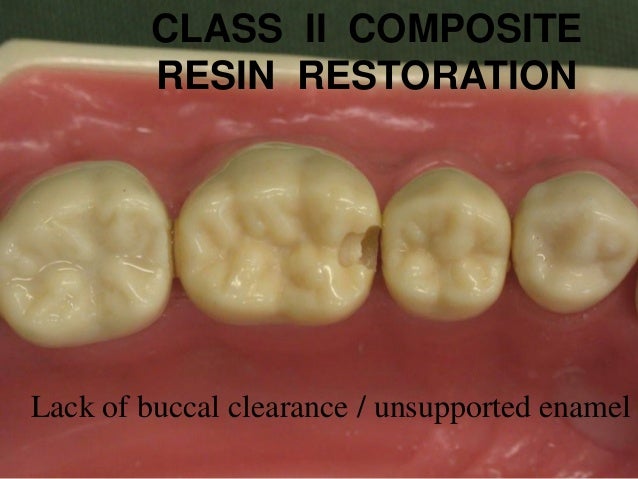 Composite Composite
