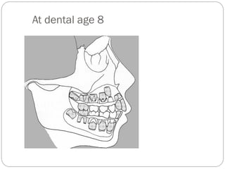 At dental age 8
 