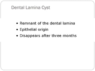Dental Lamina Cyst
 