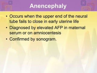 Anencephaly Occurs when the upper end of the neural tube fails to close in early uterine lifeDiagnosed by elevated AFP in maternal serum or on amniocentesis Confirmed by sonogram.