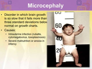 MicrocephalyDisorder in which brain growth is so slow that it fails more than three standard deviations below normal on growth charts. Causes: Intrauterine infection (rubella, cytomegalovirus, toxoplasmosis) Severe malnutrition or anoxia in infancy 