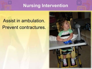Nursing InterventionAssist in ambulation. Prevent contractures.
