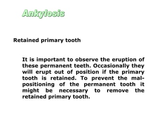 It is important to observe the eruption of
these permanent teeth. Occasionally they
will erupt out of position if the primary
tooth is retained. To prevent the mal-
positioning of the permanent tooth it
might be necessary to remove the
retained primary tooth.
Retained primary tooth
 