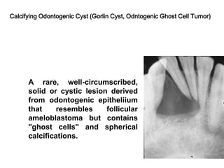 Calcifying Odontogenic Cyst (Gorlin Cyst, Odntogenic Ghost Cell Tumor)
A rare, well-circumscribed,
solid or cystic lesion derived
from odontogenic epitheliium
that resembles follicular
ameloblastoma but contains
"ghost cells" and spherical
calcifications.
 