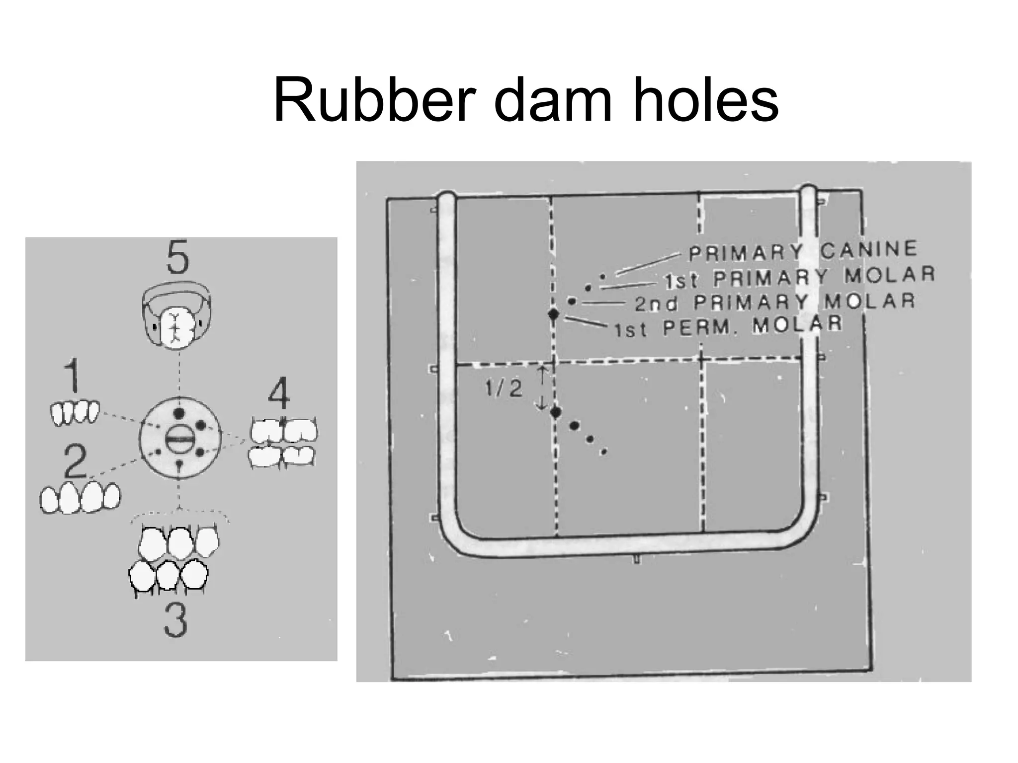 Rubber dam holes