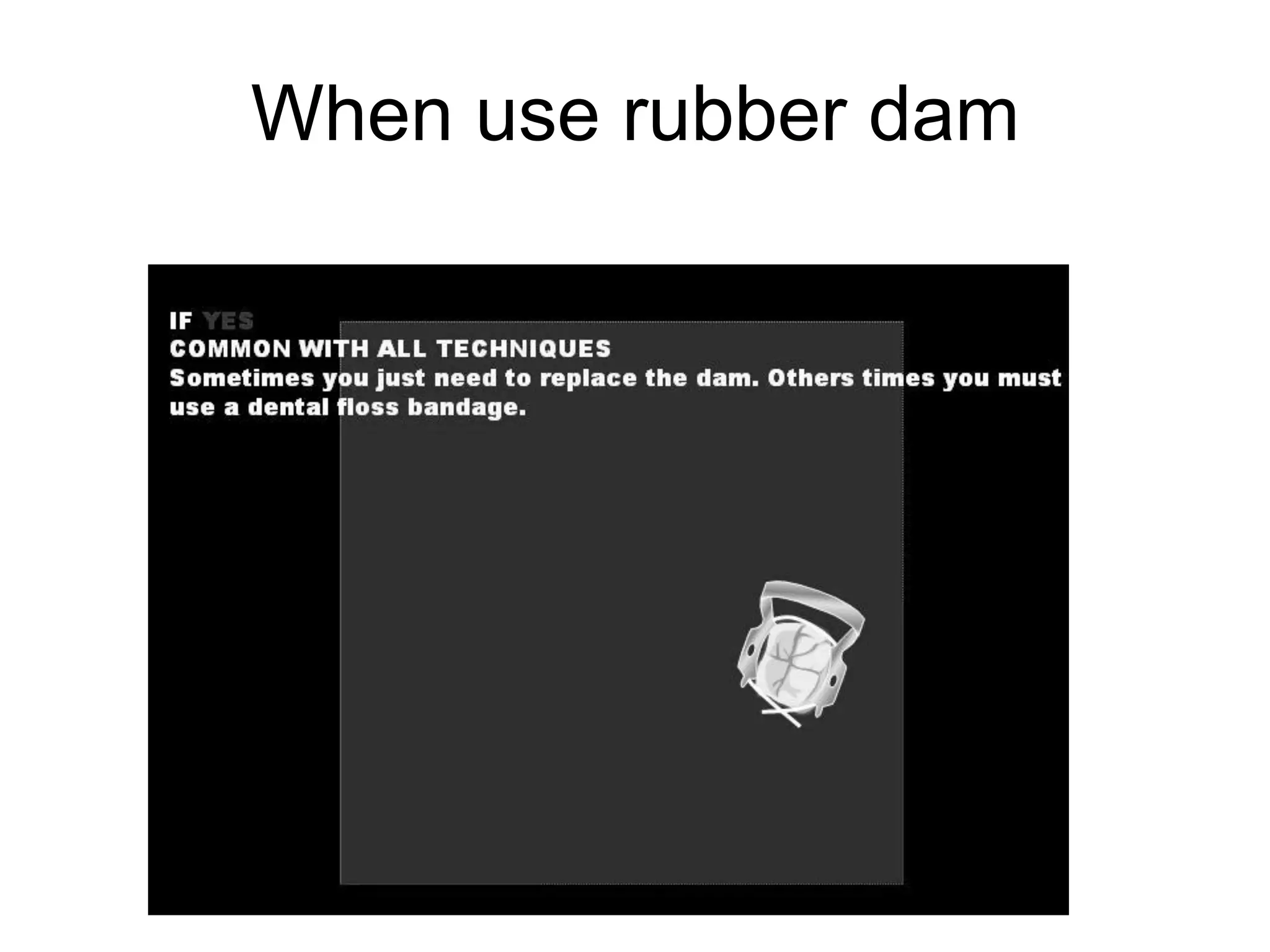 When use rubber dam