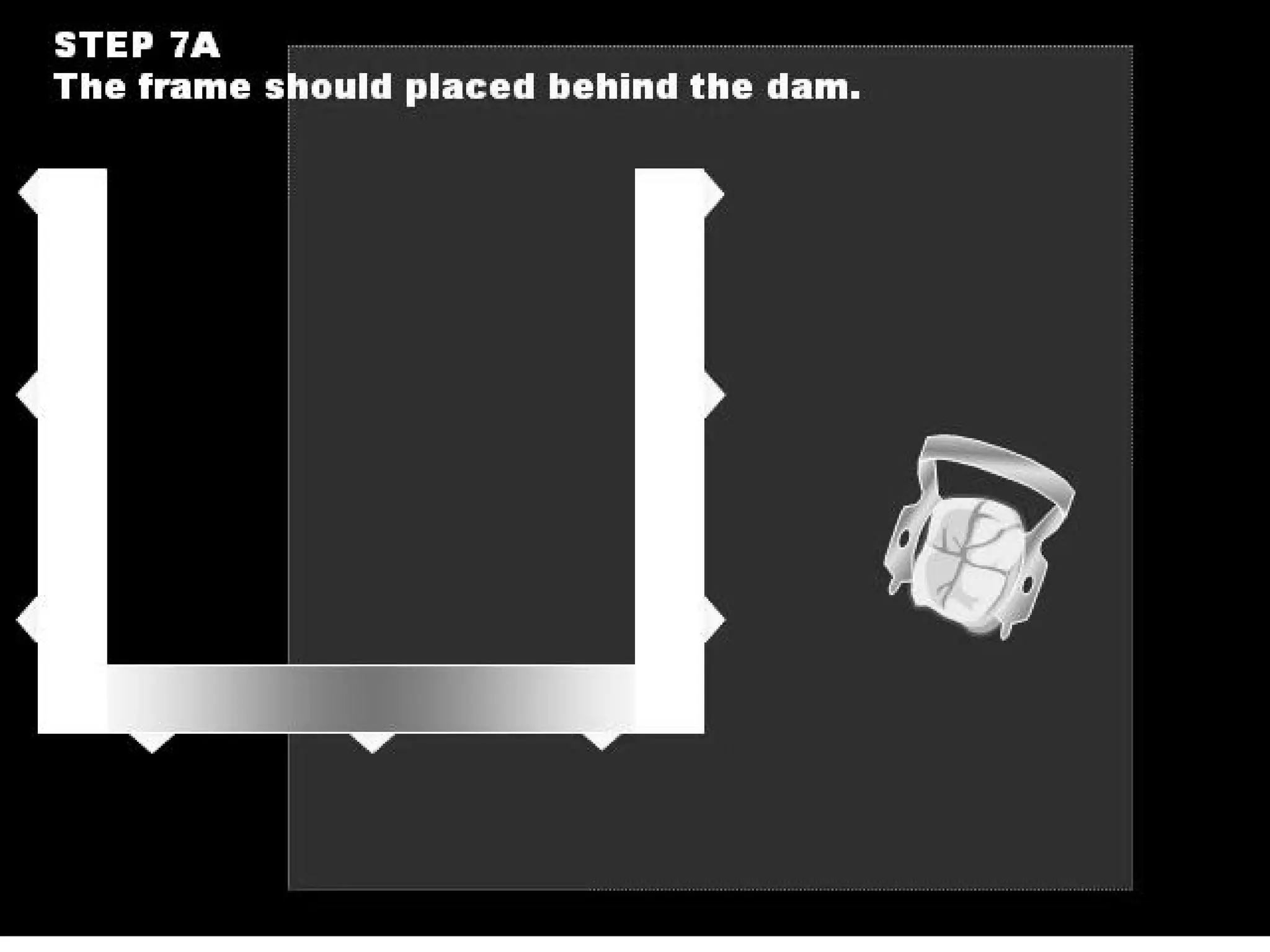 Pedia Rubber Dam application