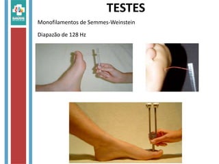 Monofilamentos de Semmes-Weinstein
Diapazão de 128 Hz
TESTES
 