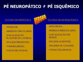 PÉ NEUROPÁTICO ‡ PÉ ISQUÊMICO
ÚLCERA NEUROPÁTICA ÚLCERA NEUROISQUÊMICA
•INDOLOR.
•BORDAS CIRCULARES.
•LOCALIZAÇÃO
PLANTAR OU LATERAL.
•PULSOS PRESENTES.
•VERMELHIDÃO.
•VEIAS DILATADAS.
•DOLOROSA.
•BORDAS IRREGULARES.
•LOCALIZAÇÃO EM
DEDOS.
•PULSOS AUSENTES.
•PALIDEZ OU CIANOSE.
•VEIAS COLABADAS.
 