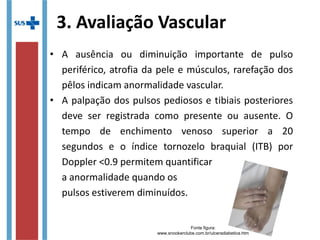 3. Avaliação Vascular
• A ausência ou diminuição importante de pulso
periférico, atrofia da pele e músculos, rarefação dos
pêlos indicam anormalidade vascular.
• A palpação dos pulsos pediosos e tibiais posteriores
deve ser registrada como presente ou ausente. O
tempo de enchimento venoso superior a 20
segundos e o índice tornozelo braquial (ITB) por
Doppler <0.9 permitem quantificar
a anormalidade quando os
pulsos estiverem diminuídos.
Fonte figura:
www.snookerclube.com.br/ulceradiabetica.htm
 