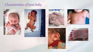 Nursing management of Preterm, Term, Post-term and IUGR Baby.pptx