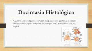 Docimasia Histológica
• Negativa: Los bronquiolos se veran colapsados y pequeños, y el epitelio
alveolar cúbico y poca sangre en los tabiques, esto nos indicará que no
respiró.
 