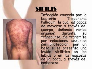 SIFILIS
 Infección causada por la
 bacteria       Treponema
 Pallidum, la cual es capaz
 de moverse a través del
 cuerpo, dañando varios
 órganos     durante     su
 transcurso. Se transmite
 por relaciones sexuales
 sin protección, por un
 beso si se presenta una
 lesión sifilítica en los
 labios o en las mucosas
 de la boca, a través del
 embarazo.
 