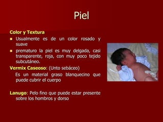 Piel
Color y Textura
 Usualmente es de un color rosado y
suave
 prematuro la piel es muy delgada, casi
transparente, roja, con muy poco tejido
subcutáneo.
Vermix Caseoso: (Unto sebáceo)
Es un material graso blanquecino que
puede cubrir el cuerpo
Lanugo: Pelo fino que puede estar presente
sobre los hombros y dorso
 