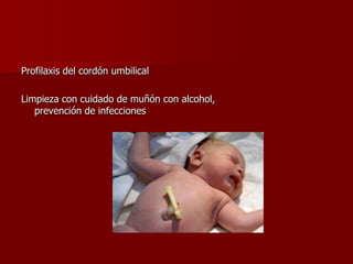 Profilaxis del cordón umbilical
Limpieza con cuidado de muñón con alcohol,
prevención de infecciones
 