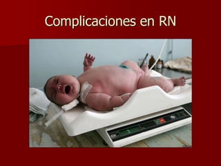 Complicaciones en RN
 