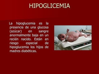 HIPOGLICEMIA
La hipoglucemia es la
presencia de una glucosa
(azúcar) en sangre
anormalmente baja en un
recién nacido. Están en
riesgo especial de
hipoglucemia los hijos de
madres diabéticas.
 